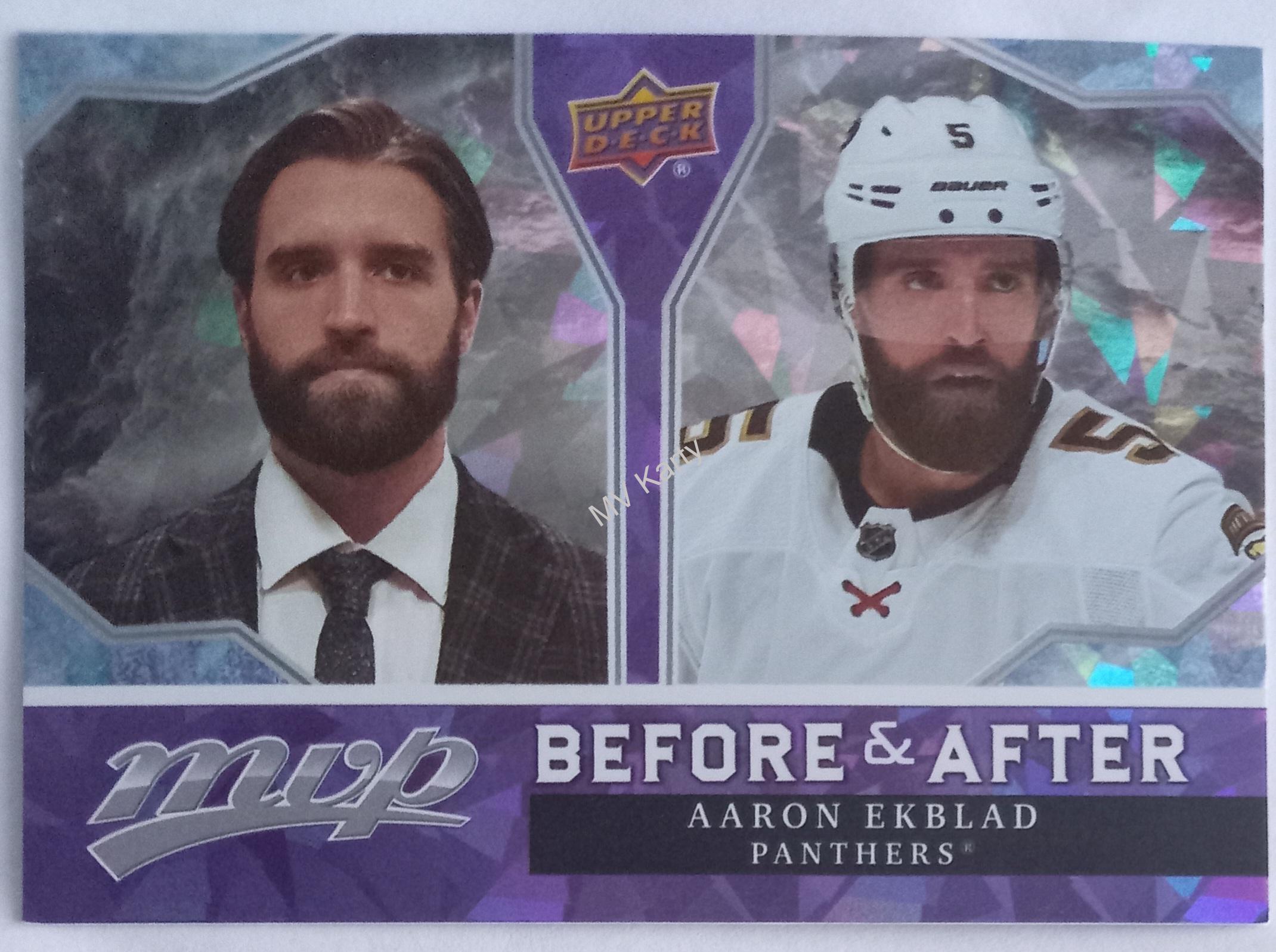 2021-22 Upper Deck MVP - Before and After #BA-20 Aaron Ekblad